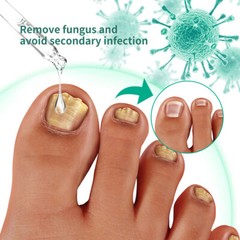 1PCS New Kerassentials Toenail Treatment Oil, Toenail for Kerassentials US