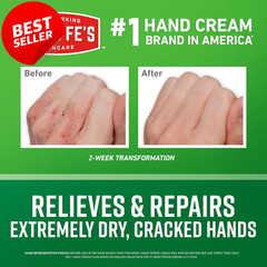 Working Hands Hand Cream 7oz for Cracked Dry Hands Repairing Moisturizer – US