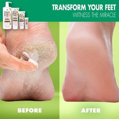 Miracle Foot Repair Cream, (1 oz / 3 Pack) Repairs Dry 1 Ounce (Pack of 3)