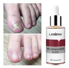 LANBENA Nail Repair Essence Nourishing Nail Care Serum Hand & Foot 12ml