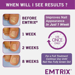 1 X EMTRIX Fungal Nail Treatment 10ml Free Shipping