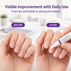 Qlear Beauty Keratin Nail Pen, Cuticle Repair Strengthening Nail Serum Treatment