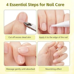 Nailz Nail 𝐆𝐫𝐨𝐰𝐭𝐡 Pen,Radiant Nail Growth GIL,Radiant Nail Growth Oil P…