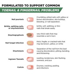 Foot Cure Toenail Fungus Treatment Extra 0.5 Fl Oz (Pack of 1), Multi-Colored