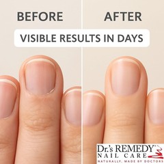 Nourishing Nail Treatment, Formula, Lavender Scent