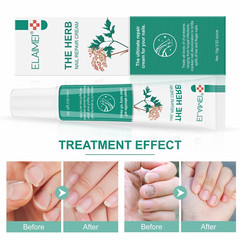 Toenail Plant-Based Care Cream For Discolored or Thickened Toenails