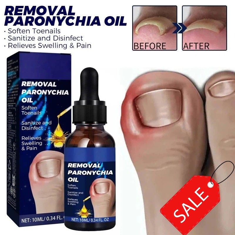 Drops Nail Care Oil Fingernails Toenails Cuticle Repair Moisturizing Nourishment