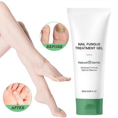 Nutraboost Nail Fungus Treatment Gel, Nail Fungus, Fungus Cream NEW 2026