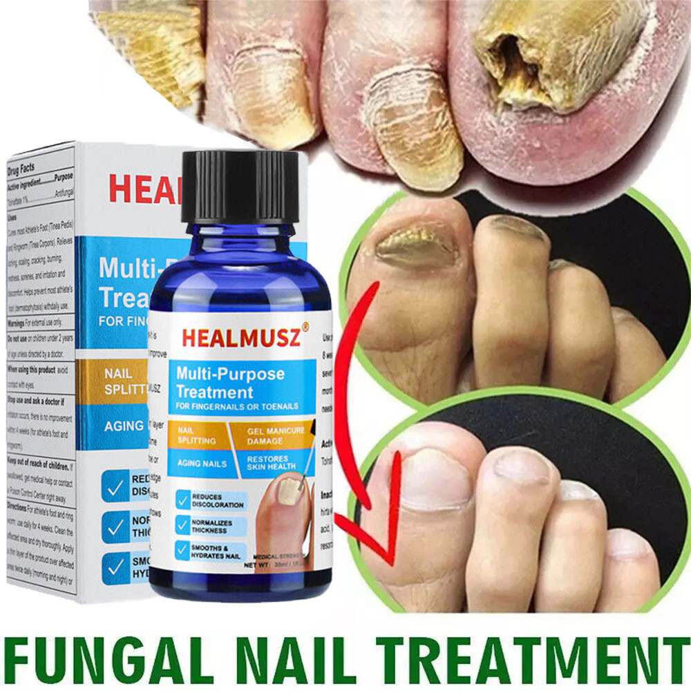 30ml Nail Repair Oil Fungal Nail Treatment Liquid Remove Toe Nail Fungus Essence