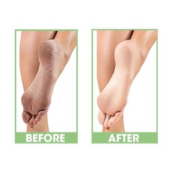 ProLinc Dry Heel Eliminator + Cuticle Eliminator 4 oz
