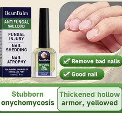 BeamBalm Antifungal Nail Liquid for Hands & Feet, 11 ml / 0.37 fl oz