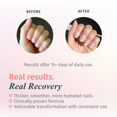 Rejuvacote 1 Nail Growth System – Maximum Strength | Nail Strengthener for Damag