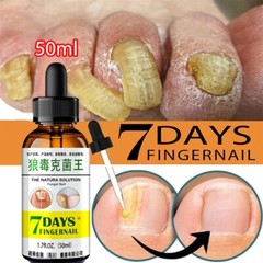 Natural Solution Fungal Nail Essence Serum Care Repair Foot Nail GET 1 FREE