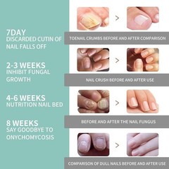 Nail Care Pen 1-6X The Original Pen Health Routin Nail Fungus