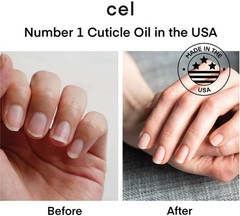 cel MD Cuticle Oil Pen Nail Strengthener Repair Serum – 0.1 Fl Oz (Pack of 2)
