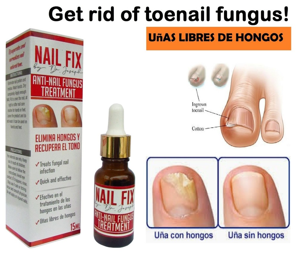 1 Antihongos Nailfix 30gr efectivo uñas de pies pie de atleta