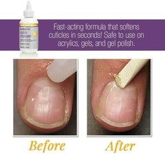 Prolinc Be Natural Cuticle Eliminator + Callus Eliminator Orange 4oz Duo