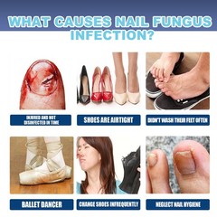 Nail Care Pen, 4/8/12Pcs Fungal Nail Pen, Nail Fungus Treatment For Toenail USA