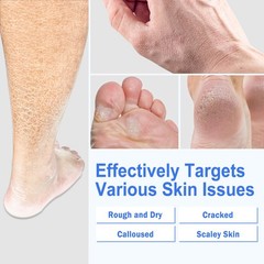 TEAWOO Ultra-Hydrating Foot up to size 8.5 | Cream + Silicone Socks