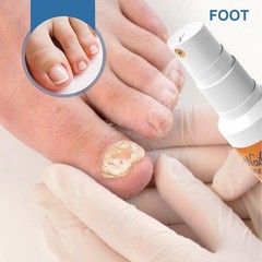Nail Fungus Relief Spray Safe Gentle Nail Strengthener Toenail Care Spray