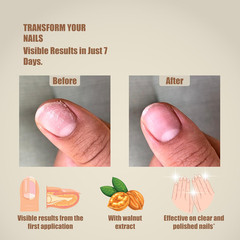 ® Nail and Cuticle Repair & Strengthening Gel | Results in 7 Days | Hydrates, Ha