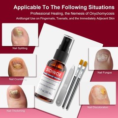 Toenail Fungus Treatment, Treatment Extra Strength 1 Fl Oz (Pack of 5), Red