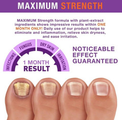 Pureskin Fungal Nail Toenail Renewal 50ml Toe Finger Nail Health Support New