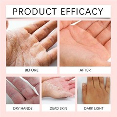 Retinol Hand Cream Moisturize Relief Anti Ageing -50g US