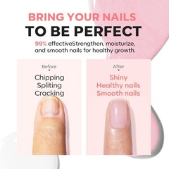 modelones Nail Strengthener, Sparkle 0.5 Fl Oz (Pack of 1), A4-Glitter Pink