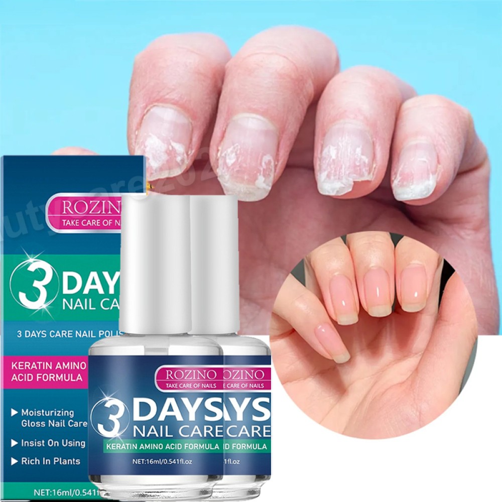 2PCS ROZINO 3 Days Nail Care – Keratin Amino Acid Formula Superior Nail Nourish
