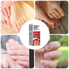 Fungi-Nail Anti-Fungal Liquid Solution Kills Fungus That Can Lead To Nail