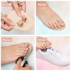 Nuanchu 6 Pieces Double Hammer Toe Straightener Budin One Size, Beige