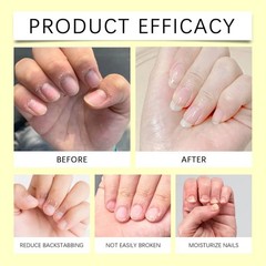 Nail Growth Oil for Hydration & Cuticle Strengthening Natural Nail Health Care