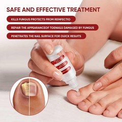DERMFREE Toenail Treatment,Gentle Formula, 0.5 Fl Oz (Pack of 2), red