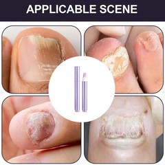 Nail Strengthener Fingernail Strengthener Chip-resistant Cuticle-