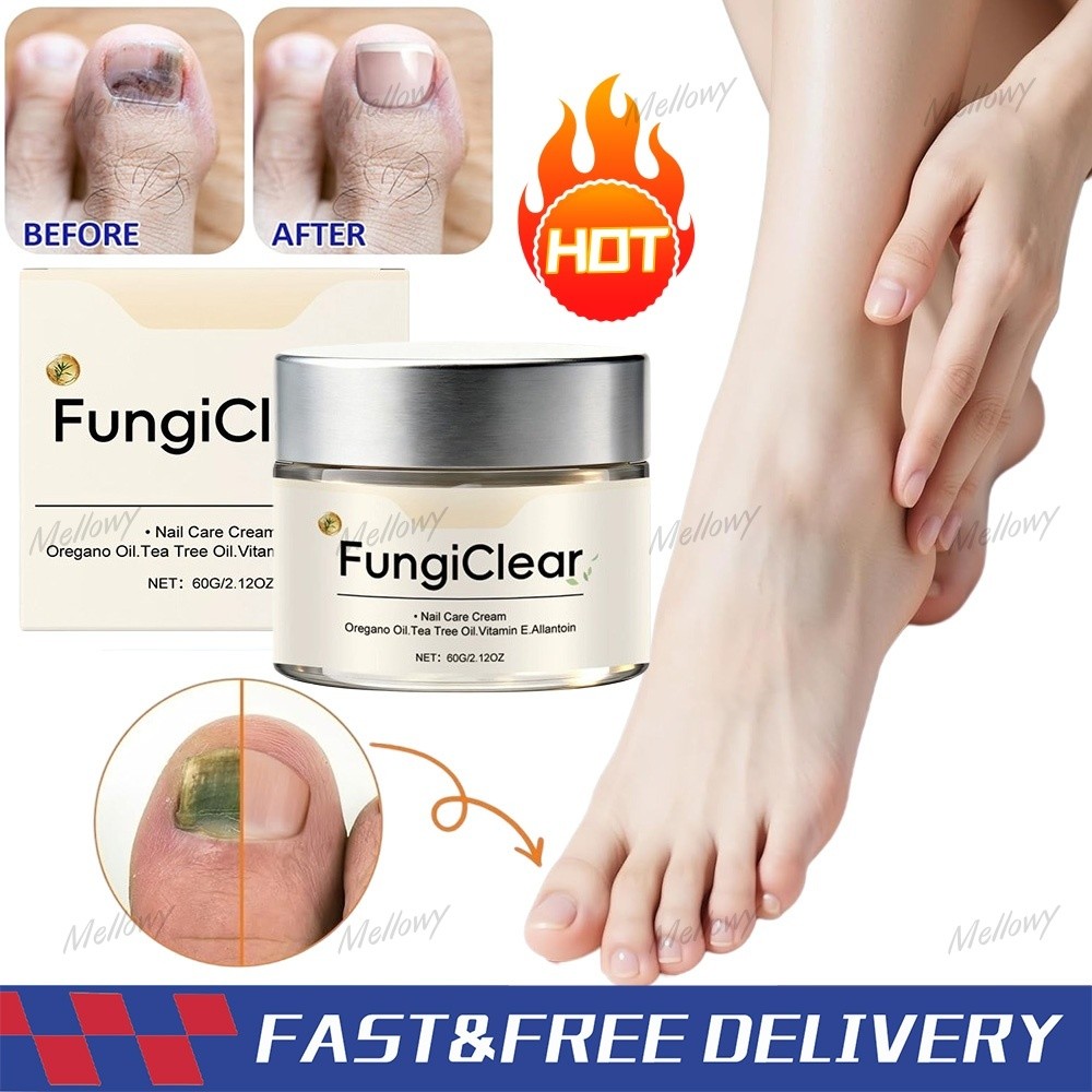 FungiClear Phrena Nail Care Cream With Tea Tree Oil, Oregano Oil, Vitamin E ~US