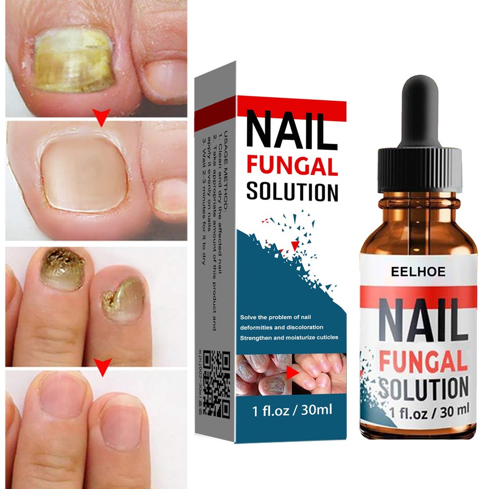 Nail Repair Liquid for Fungal Nails, Toenail Treatment ; Nail Strengthening