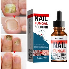 Nail Repair Liquid for Fungal Nails, Toenail Treatment ; Nail Strengthening