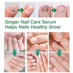 Natural Fingernail Essence Oil Nail Growth Strengthener Fungus Treatment Care