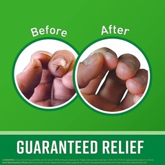 O’Keeffe’s Working Hands Hand Cream for Extremely Dry, Cracked Hands, 3.4 Ounce