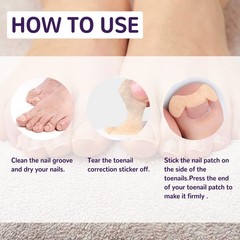 Ingrown Toenail Patch Elastic Nail Corrector Strip Non-Woven Toenail Care Tape