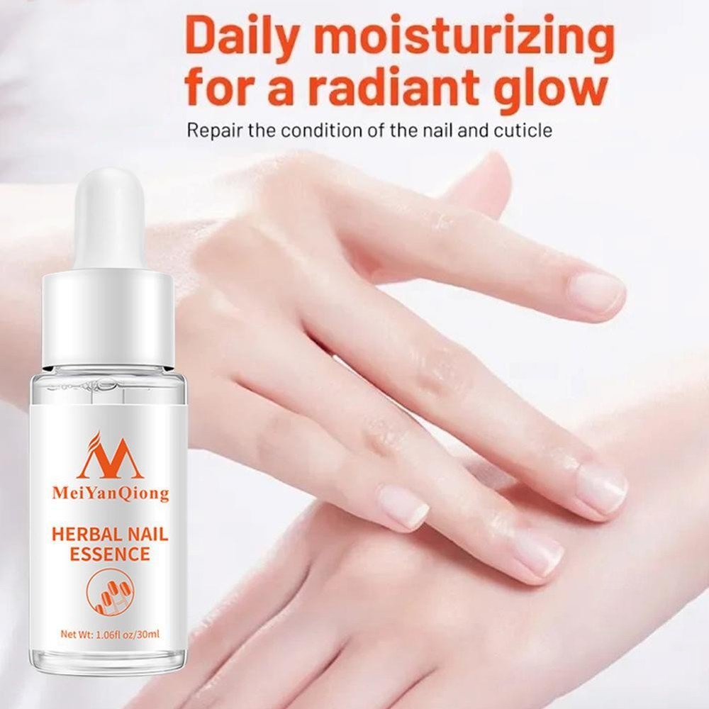 Herbal Toenail Repair Essence Effective Nail Whitening For Women Men P2Y2 _30ml.