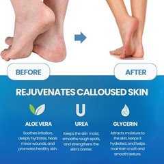 Imperial Feet Callus Remover for Extra Strength With File