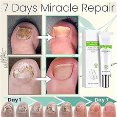 2 Pics Nail Treatment Repair Gel Cream Toe Be Health Instant in 7 Days Treatment