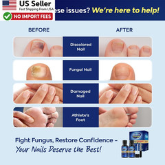 Toenail Fungus Treatment 25pct Undecylenic Acid AthletesFoot 2pcs Kit FROM USA