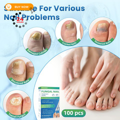 Fungal Nail Treatment Swabs–100 Ct, Extra 0.02 Fl Oz (Pack of 100), White