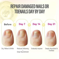 Natural Nail and Cuticle Repair Oil – Strengthening Jojoba & Tea Tree Serum