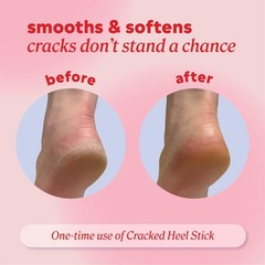 Onyx Professional Cracked Heel Repair Balm 2.46 Ounce (Pack of 1), Clear