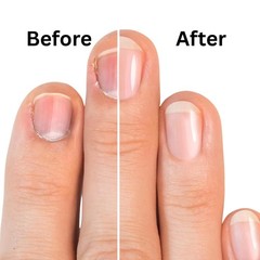 Dead Sea Cuticle & Nail Oil (5ML) | Strengthens, Moisturizes & Conditions wit…