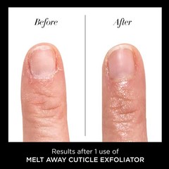 Cuticle Remover Liquid – Fast-Acting Cuticle Oil Exfoliator & Softener 0.4 Fl Oz